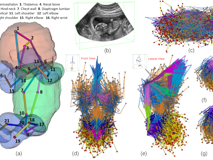 球盟会QMH(中国)官方网站
倪东教授团队在《Medical Image Analysis》上发表文章