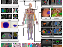 球盟会QMH(中国)官方网站
倪东教授团队在《Medical Image Analysis》上发表文章